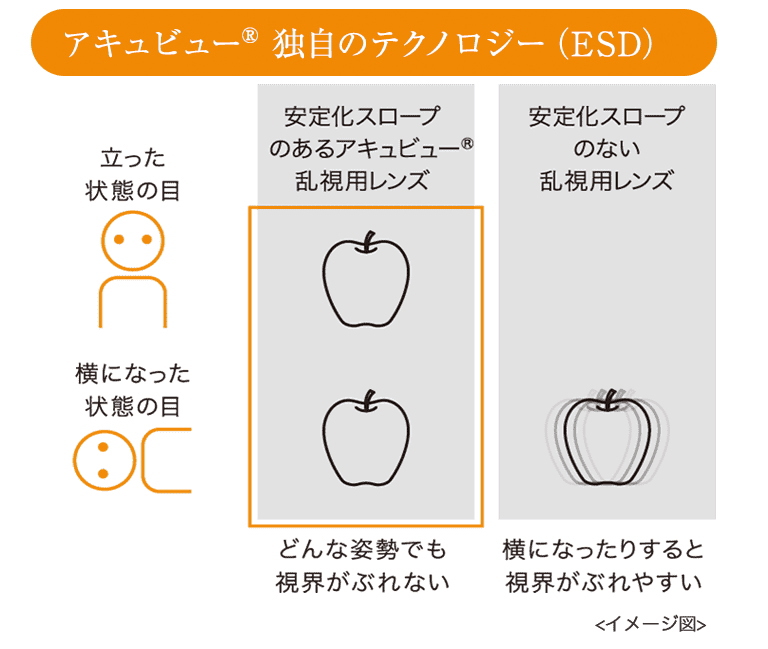 安定化スロープで乱視をしっかり矯正